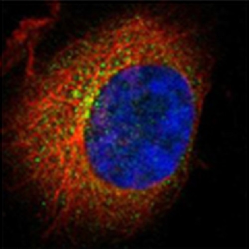 Fig.5 taken from Jakobsen et al, 2011.