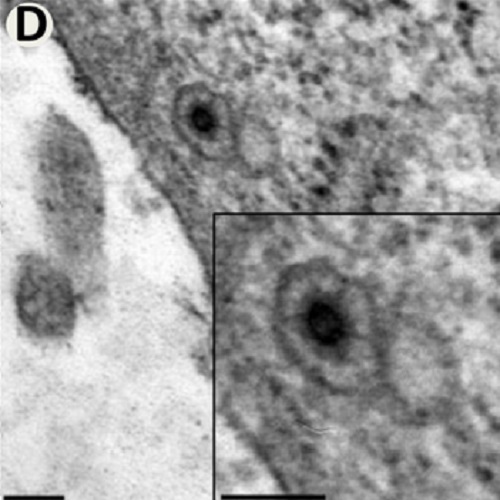 Fig.1 taken from Stirnnangel et al, 2012.