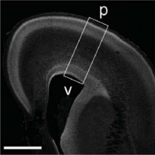 Fig.1 taken from Turrero-Garcia et al, 2016.